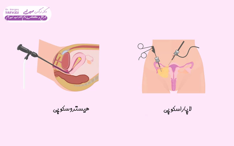 هیستروسکوپی چیست و چرا آماده‌سازی اهمیت دارد؟