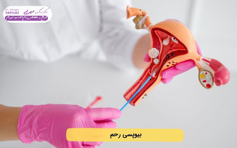 مراقبت بعد از بیوپسی رحم