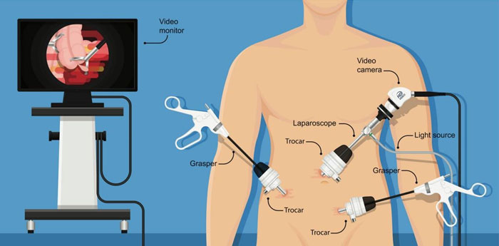 بهترین دکتر لاپاراسکوپی اقدسیه