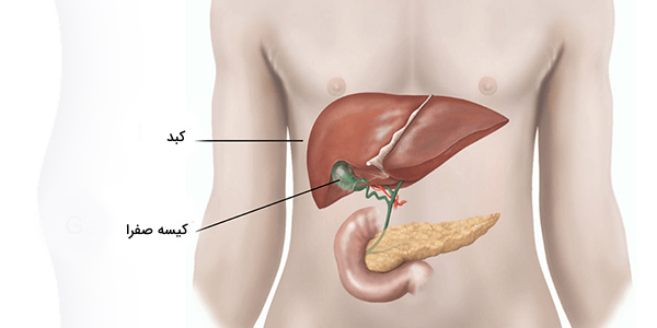 هزینه لاپاراسکوپی کیسه صفرا