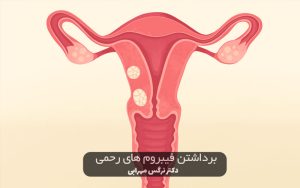 جراحی برداشتن فیبروم