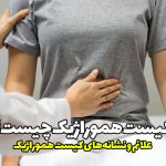 علائم و نشانه‌های کیست هموراژیک