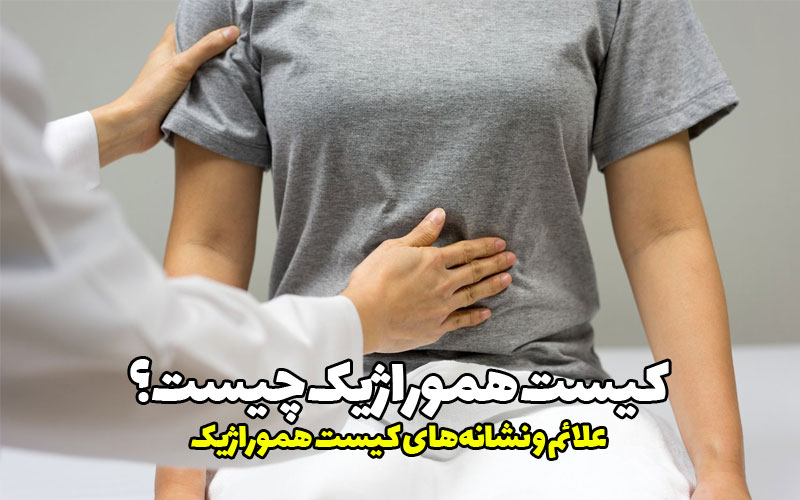 علائم و نشانه‌های کیست هموراژیک