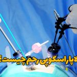 لاپاراسکوپی رحم چیست