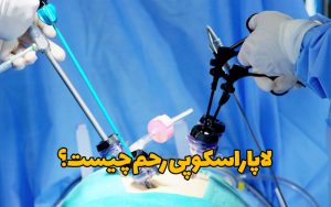 لاپاراسکوپی رحم چیست