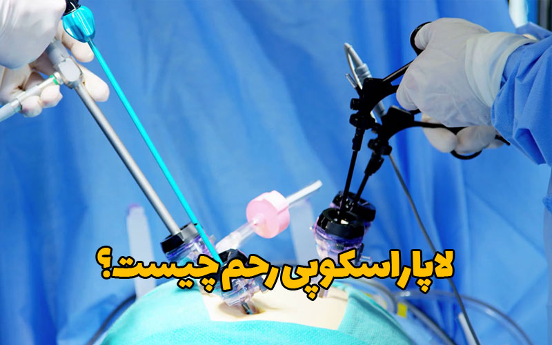 لاپاراسکوپی رحم چیست