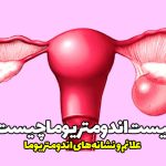 کیست اندومتریوما