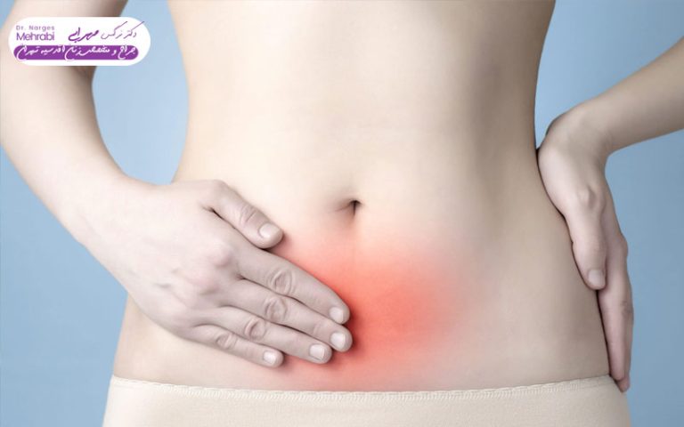 درد بعد از لاپاراسکوپی رحم