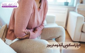 لاپاراسکوپی آندومتریوز