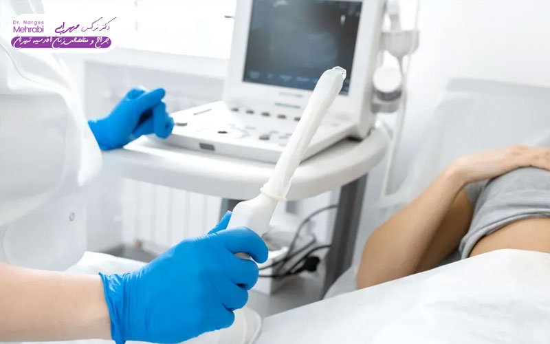 بهترین زمان برای سونوگرافی رحم و تخمدان