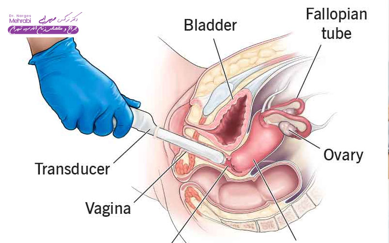 نقش سونوگرافی در تشخیص بیماری‌ها