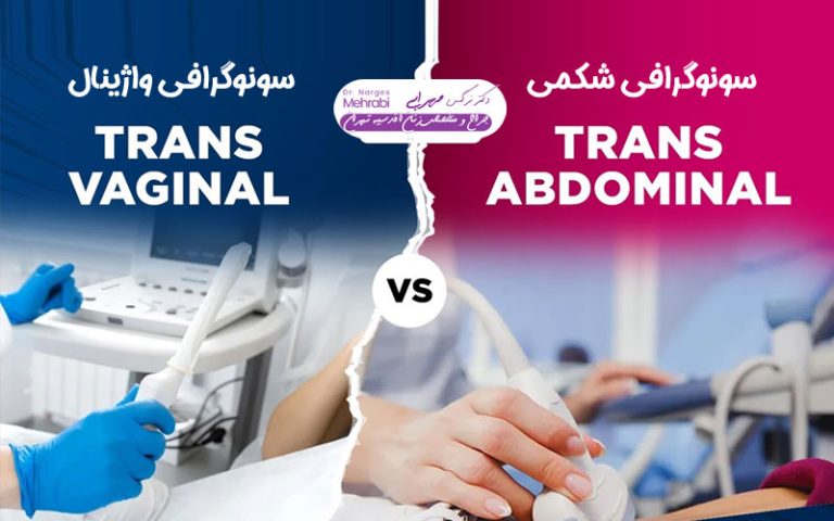 تفاوت سونوگرافی واژینال و شکمی