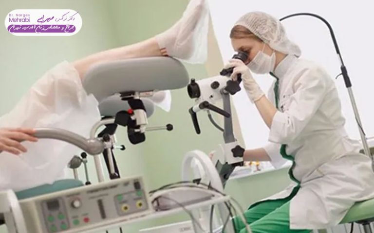 مراقبت بعد از بیوپسی دهانه رحم