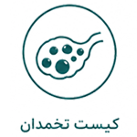 کیست تخمدان
